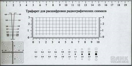 Трафарет для расшифровки рентгеновских снимком